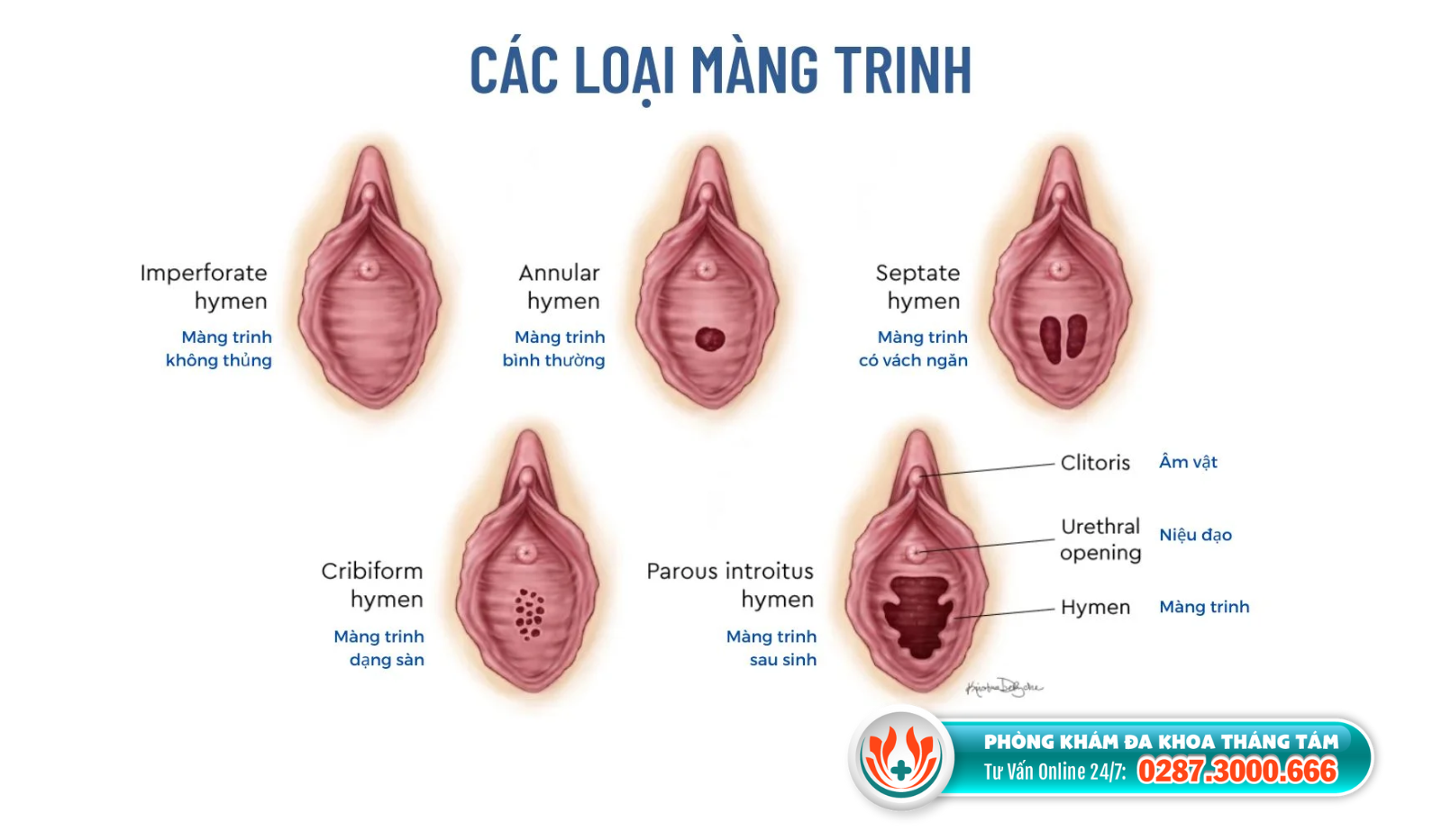 va-mang-trinh-tphcm